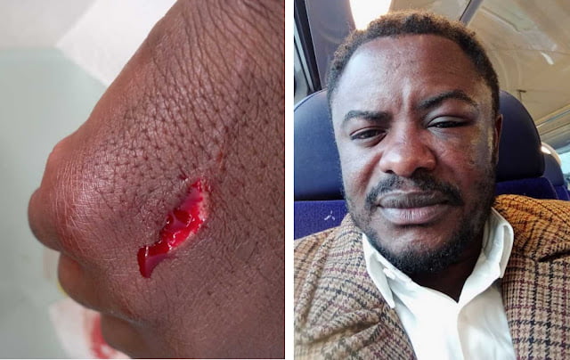 Ndinga de Deus, jovem político e membro da UNITA, “gredido” pelos militantes do MPLA, na França