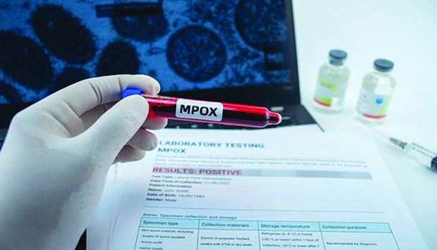 OMS critica informações alarmistas sobre a Mpox